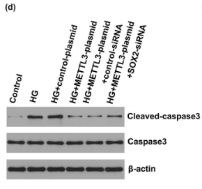 Caspase 3 Antibody - Figure 6 Effect of SOX2-siRNA and METTL3-plasmid on HG-induced HRECs viability and apoptosis.