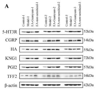 KNG1 Antibody - Figure 4 EA stimulation of Guanyuan acupoint reduces the expression of pain-causing substances and inflammatory mediators in rats with PID.