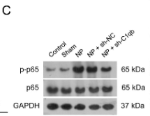 Phospho-NF-kB p65 (Ser536) Antibody - FIGURE 7 C1qb knockdown alleviated the NP performance.