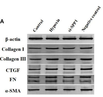 CTGF Antibody - Figure 3.