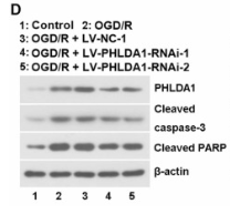 Cleaved-Caspase 3 (Asp175), p17 Antibody - Fig.