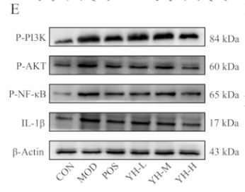 Phospho-PI3K p85 (Tyr458)[Tyr467]/p55 (Tyr199) Antibody - Figure 5: Attenuation of podocyte injury by inhibiting the PI3K/AKT/NF-κB signaling pathway.