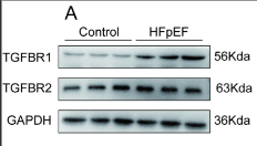 TGFBR2 Antibody - ig 1.