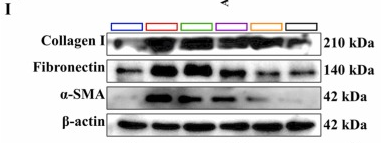 Fibronectin Antibody - Fig.