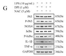 NF-kB p65 Antibody - Figure 3.