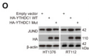 JunD Antibody - Figure 5 YTHDC1 enhances the mRNA stability of NECTIN4 transcription factor JUND in a m6A-dependent manner (A) The Ominer network tool predicts potential transcription factors for NECTIN4.
