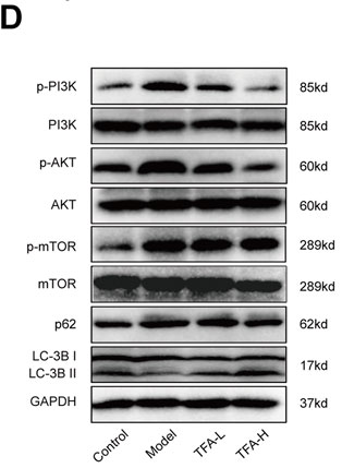 LC3B Antibody - Figure 6.
