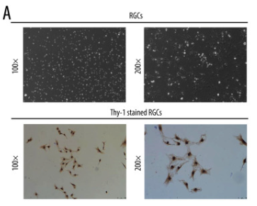 THY1 Antibody - Figure 1.