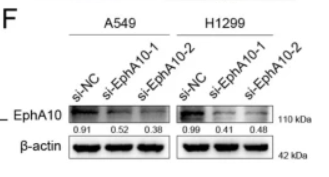 EPHA10 Antibody - Figure 8 Validation of the oncogenic role of EphA10 in NSCLC.