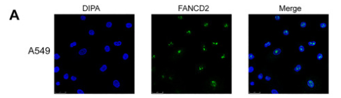 FANCD2 Antibody - Fig.