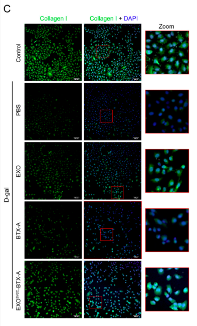 Collagen I Antibody - Figure 4.