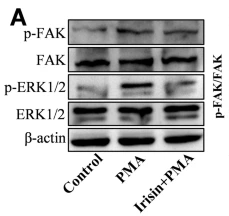 Phospho-ERK1/2 (Thr202/Tyr204) Antibody - Fig.