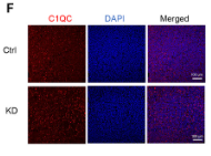C1QC Antibody - Figure 6 SLAMF3 promoted M2 macrophage infiltration in mouse liver metastatic niche.