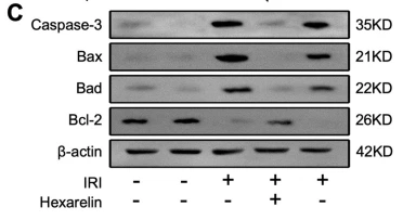 BAD Antibody - Fig.