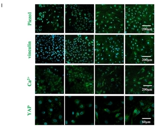 YAP Antibody - Figure 7 NBT and NBTP surfaces promote HUVEC spreading, proliferation, and angiogenesis.
