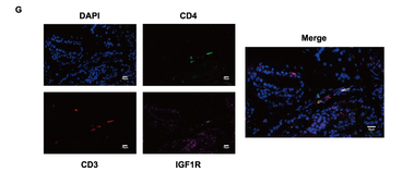 IGF1R/Insulin Receptor Antibody - Figure 2 IGF1-related ligands and IGF1R’ s expression in EAP and Control groups.