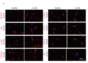TGF beta 1 Mouse monoclonal Antibody - Fig.