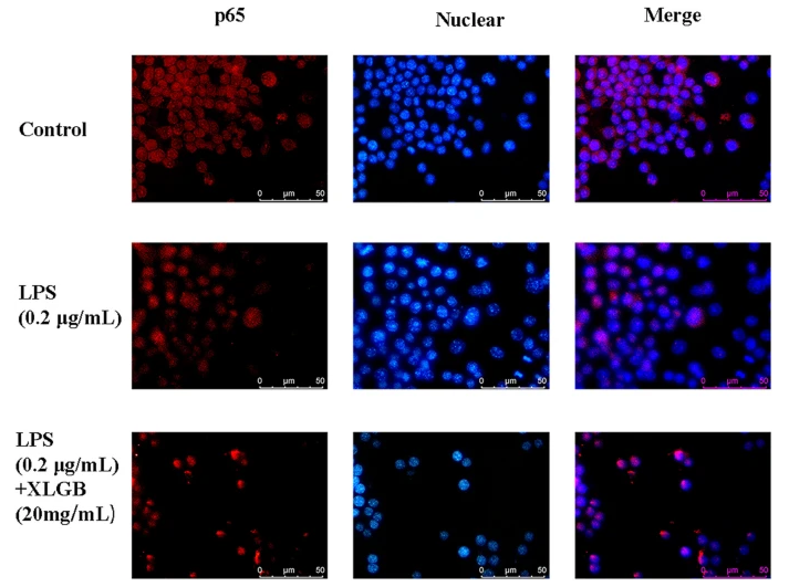 KLK3 Antibody - Fig.