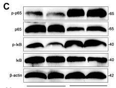 Phospho-IKB alpha (Ser32/Ser36) Antibody - Fig.