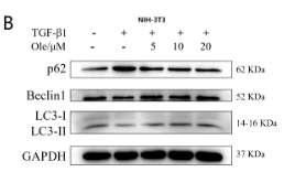 Beclin 1 Antibody - Figure 5.