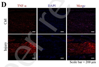TNF alpha Antibody - Figure 5.