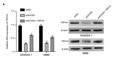 TRPV4 Antibody - Fig.