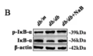 Phospho-IKB alpha (Ser32/Ser36) Antibody - Fig.