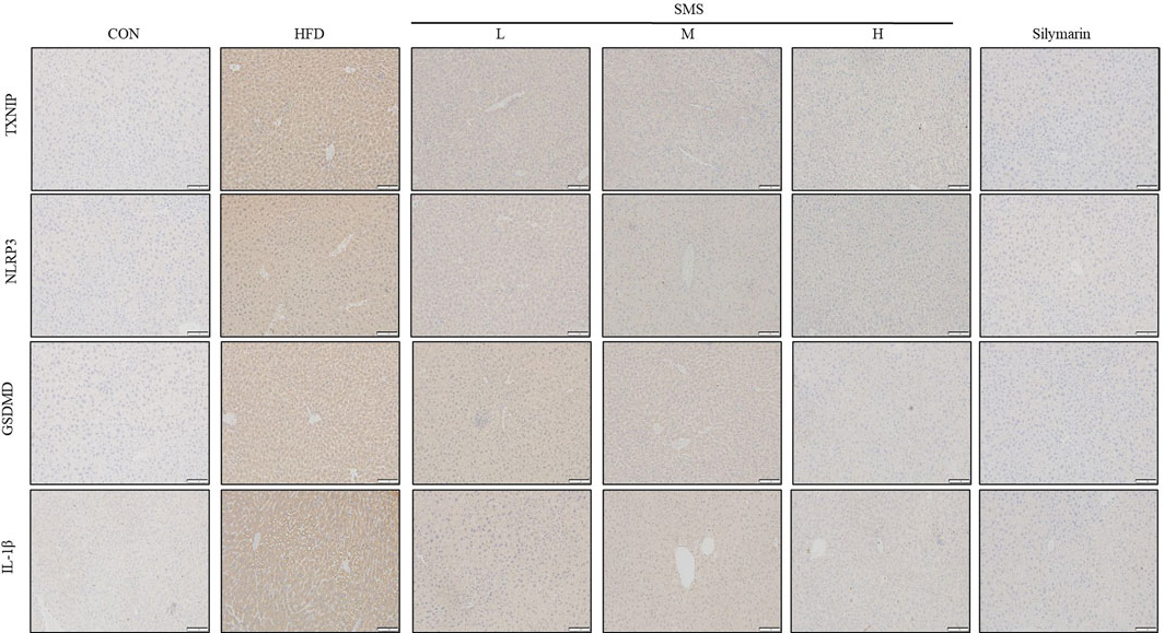 IL1 beta Mouse Monoclonal Antibody - Figure 5.