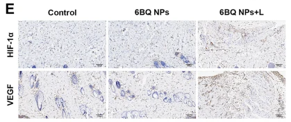 HIF1A Antibody - Fig.