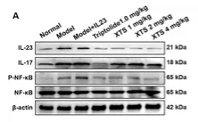 Phospho-NF-kB p65 (Ser536) Antibody - Figure 8.