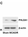 PHLDA1 Antibody - Fig.