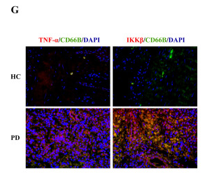 IKK-beta Antibody - Fig.