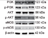 Phospho-AKT1/2/3 (Ser473) Antibody - Figure 5 Modulation of the PI3K/AKT/eNOS signaling pathway by Rb1.