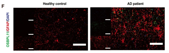 OSBPL11 Antibody - Fig.