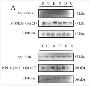 PI3K p85 alpha Antibody - Figure 8.