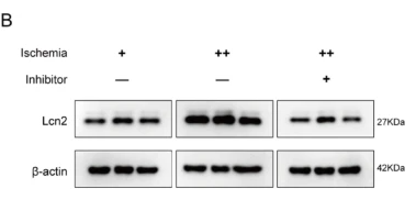 LCN2 Antibody - Fig.