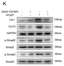 Phospho-Smad2 (Ser465+Ser467) Antibody - Fig 3.