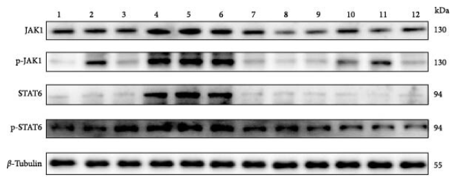 Phospho-JAK1 (Tyr1022)[Tyr1034] Antibody - Figure 9 (A) Protein contents of JAK1, p-JAK1, STAT6, and p-STAT6.