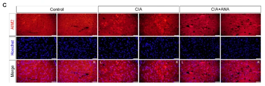 AIM2 Antibody - Fig.
