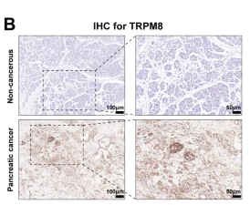 TRPM8 Antibody - Fig.