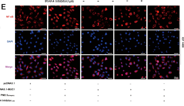 NF-kB p65 Antibody - Figure 2.