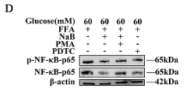 Phospho-NF-kB p65 (Ser536) Antibody - Fig.