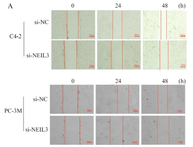 NEIL3 Antibody - Fig.