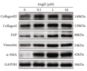 Vimentin mouse monoclonal Antibody - Figure 5 (d) (a) Fluorescence microscopy (10×) of FAP-293T cells postpuromycin screening showed eGFP (green) expression in successfully transduced cells.