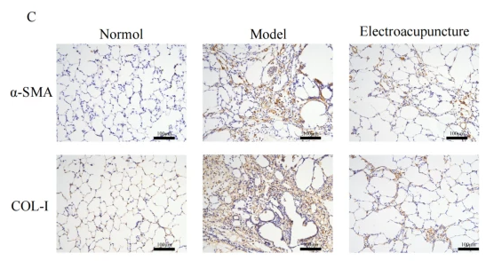 Collagen I Antibody - Fig.