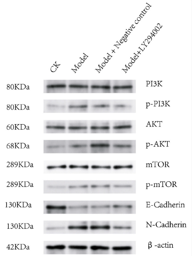 PI3K p85 alpha Antibody - Figure 5.