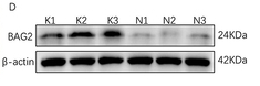 BAG2 Antibody - Figure 1 The expression of BAG2 in keloid and normal skin samples.