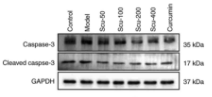 Cleaved-Caspase 3 (Asp175), p17 Antibody - Figure 2 - Protein expression levels of apoptosis-related factors determined by western blotting.