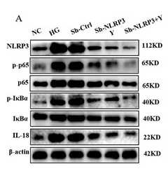 IKB alpha Antibody - Figure 3Yimusake can inhibit the expression of the NLRP3 inflammasome-mediated NF-κB signaling pathway in vitro.