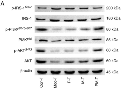 Phospho-PI3K p85 alpha (Tyr607) Antibody - Figure 7.